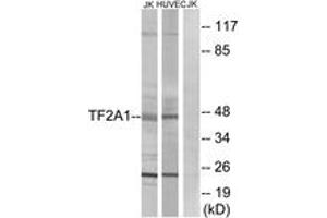 Western blot analysis of extracts from Jurkat/HuvEc cells, using TF2A1 Antibody. (GTF2A1 anticorps  (AA 281-330))