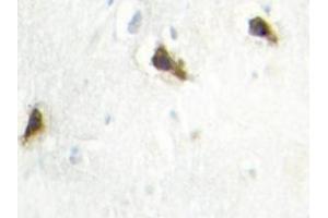 Image no. 2 for anti-Histidyl-tRNA Synthetase (HARS1) antibody (ABIN272164) (HARS1/Jo-1 anticorps)