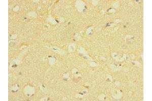 Immunohistochemistry of paraffin-embedded human brain tissue using ABIN7158206 at dilution of 1:100