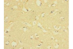 Immunohistochemistry of paraffin-embedded human brain tissue using ABIN7158206 at dilution of 1:100 (Lrig1 anticorps  (AA 35-220))