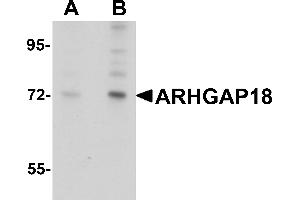 Western Blotting (WB) image for anti-rho GTPase Activating Protein 18 (ARHGAP18) (C-Term) antibody (ABIN1030254)