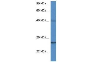 Western Blot showing CCS antibody used at a concentration of 1 ug/ml against MDA-MB-435S Cell Lysate (Superoxide dismutase copper chaperone anticorps  (C-Term))