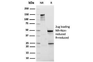 SDS-PAGE Analysis Purified NKX3. (NKX3-1 anticorps  (AA 92-224))