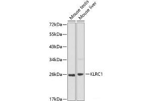 Western blot analysis of extracts of various cell lines using KLRC1 Polyclonal Antibody at dilution of 1:1000. (KLRC1 anticorps)