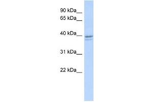 RRM2 antibody used at 1 ug/ml to detect target protein.