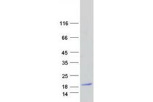 Validation with Western Blot