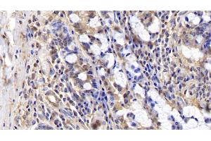 Detection of ERK2 in Porcine Small intestine Tissue using Polyclonal Antibody to Extracellular Signal Regulated Kinase 2 (ERK2)