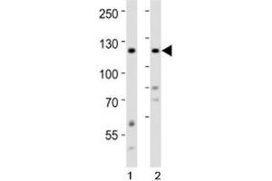 Western blot analysis of lysate from 1) HeLa and 2) SH-SY5Y cell line using Ror2 antibody at 1:1000. (ROR2 anticorps  (AA 750-800))
