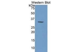 WB of Protein Standard: different control antibodies against Highly purified E. (PML Kit ELISA)