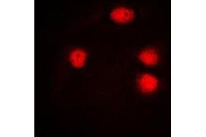 Immunofluorescent analysis of ELF5 staining in HuvEc cells. (ELF5 anticorps  (C-Term))