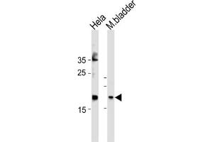Western Blotting (WB) image for anti-Family with Sequence Similarity 159, Member A (FAM159A) antibody (ABIN3004605) (FAM159A anticorps)