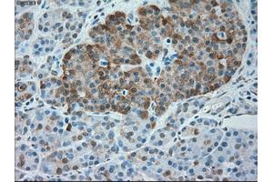 Immunohistochemical staining of paraffin-embedded Kidney tissue using anti-SERPINA1mouse monoclonal antibody. (SERPINA1 anticorps)