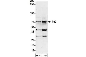 Western Blotting (WB) image for anti-Proprotein Convertase Subtilisin/kexin Type 2 (PCSK2) (AA 150-200) antibody (ABIN7454823)