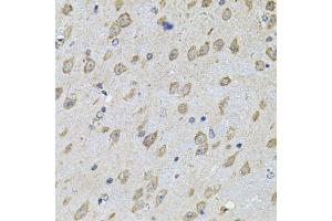 Immunohistochemistry of paraffin-embedded mouse brain using NFU1 Antibody.