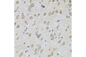 Immunohistochemistry of paraffin-embedded mouse brain using NFU1 Antibody. (NFU1 anticorps  (AA 1-230))