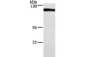Western Blot analysis of Human tongue cancer tissue using DSG1 Polyclonal Antibody at dilution of 1:750 (Desmoglein 1 anticorps)
