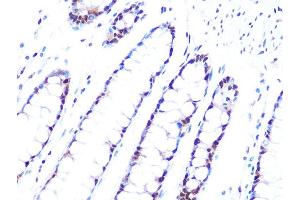 Immunohistochemistry of paraffin-embedded human colon using PRPF8 Rabbit mAb (ABIN7269737) at dilution of 1:100 (40x lens).