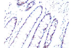 Immunohistochemistry of paraffin-embedded human colon using PRPF8 Rabbit mAb (ABIN7269737) at dilution of 1:100 (40x lens). (PRPF8 anticorps)