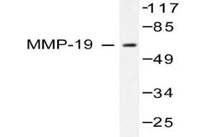 Image no. 2 for anti-Matrix Metallopeptidase 19 (MMP19) antibody (ABIN265528) (MMP19 anticorps)