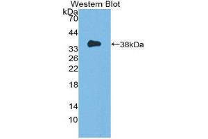 Western Blotting (WB) image for anti-Induced Myeloid Leukemia Cell Differentiation Protein Mcl-1 (MCL1) (AA 6-328) antibody (ABIN1869117) (MCL-1 anticorps  (AA 6-328))