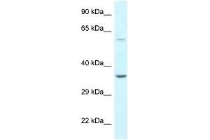 Western Blot showing BAG5 antibody used at a concentration of 1 ug/ml against Hela Cell Lysate (BAG5 anticorps  (N-Term))