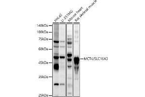 Western blot analysis of extracts of various cell lines, using MCT4/SLC16 antibody (ABIN6129472, ABIN6147859, ABIN6147860 and ABIN6214836) at 1:1000 dilution. (SLC16A3 anticorps  (AA 371-465))