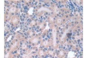 Detection of LEP in Rat Kidney Tissue using Polyclonal Antibody to Leptin (LEP)