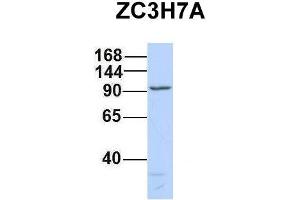 Host:  Rabbit  Target Name:  ZC3H7A  Sample Type:  721_B  Antibody Dilution:  1. (ZC3H7A anticorps  (Middle Region))