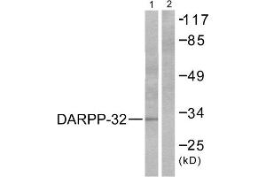 Western blot analysis of extracts from 293 cells treated with EGF (200ng/ml, 30min), using DARPP-32 (epitope around residue 75) antibody (ABIN5976153, Line 1 and 2). (DARPP32 anticorps  (Thr75))