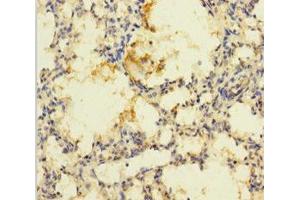Immunohistochemistry of paraffin-embedded human lung tissue using ABIN7168904 at dilution of 1:100 (PRSS23 anticorps  (AA 20-383))
