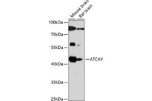 Western blot analysis of extracts of various cell lines, using ATCAY antibody (ABIN7265707) at 1:1000 dilution. (ATCAY anticorps  (AA 1-105))