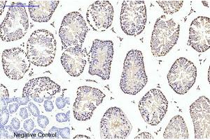 Immunohistochemical analysis of paraffin-embedded mouse testis tissue. (TUBB2A anticorps)