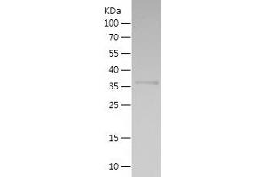 Western Blotting (WB) image for Kelch-Like ECH-Associated Protein 1 (KEAP1) (AA 378-486) protein (His-IF2DI Tag) (ABIN7123669) (KEAP1 Protein (AA 378-486) (His-IF2DI Tag))