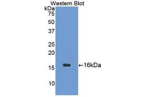 Detection of Recombinant SCT, Mouse using Polyclonal Antibody to Secretin (SCT)