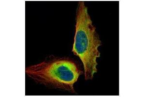 ICC/IF Image Confocal immunofluorescence analysis (Olympus FV10i) of paraformaldehyde-fixed U2OS, using NFkB p65, antibody (Green) at 1:500 dilution.