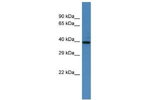 Western Blotting (WB) image for anti-Spermatogenesis Associated 2 (SPATA2) (N-Term) antibody (ABIN2774247) (SPATA2 anticorps  (N-Term))