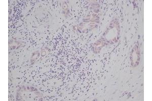 Image no. 2 for anti-KIT Ligand (KITLG) antibody (ABIN465573)