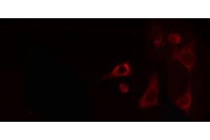 ABIN6268787 staining COLO205 cells by IF/ICC.