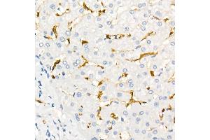 Immunohistochemistry of paraffin-embedded Human liver using Fascin/FSCN1 antibody (ABIN7267142) at dilution of 1:100 (40x lens). (Fascin anticorps)