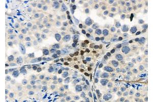 ABIN6265840 and ABIN6277615 at 1/100 staining Mouse testis tissue by IHC-P. (UBD anticorps  (Internal Region))