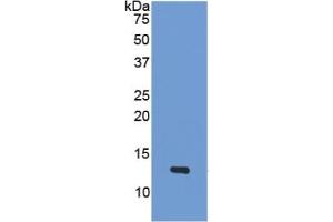 WB of Protein Standard: different control antibodies  against Highly purified E. (PF4 Kit ELISA)