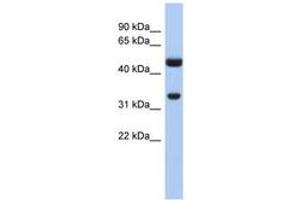 Image no. 1 for anti-Sulfotransferase Family 1B Member 1 (SULT1B1) (AA 71-120) antibody (ABIN6743489) (SULT1B1 anticorps  (AA 71-120))