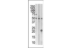 The anti- STYK1 Pab (ABIN392121 and ABIN2837982) is used in Western blot to detect STYK1 in 293 , CEM (center), and mouse kidney cell line/tissue lysates. (STYK1 anticorps  (N-Term))