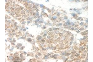 Image no. 5 for anti-Leptin (LEP) antibody (ABIN465530) (Leptin anticorps)