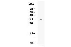 Western blot analysis of CD7 using anti-CD7 antibody . (CD7 anticorps  (AA 26-172))