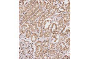 Immunohistochemical analysis of C on paraffin-embedded Human kidney tissue.