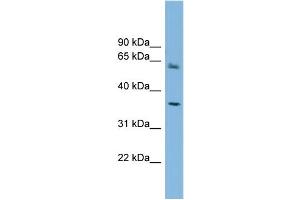 WB Suggested Anti-PEX26  Antibody Titration: 0. (PEX26 anticorps  (Middle Region))
