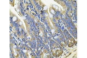 Immunohistochemistry of paraffin-embedded Mouse intestine using EIF3C Polyclonal Antibody at dilution of 1:100 (40x lens). (EIF3C anticorps)