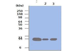 Western blot analysis: Lane 1 : 293T Lane 2 : HeLa Lane 3 : Jurkat Cell lysates of 293T, HeLa and Jurkat (each 50ug) were resolved by SDS-PAGE, transferred to PVDF membrane and probed with anti-human Pin1 (1:500). (PIN1 anticorps)