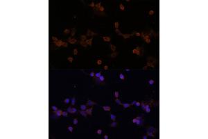 Immunofluorescence analysis of NIH-3T3 cells using UBE2L3 Polyclonal Antibody (ABIN1683196, ABIN3018653, ABIN3018655 and ABIN6220527) at dilution of 1:100 (40x lens). (UBE2L3 anticorps  (AA 73-212))
